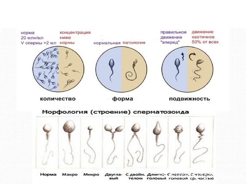 Спермограмма